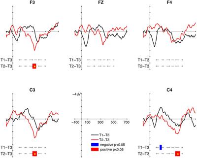 The Development of Mismatch Responses to Mandarin Lexical Tone in 12- to 24-Month-Old Infants